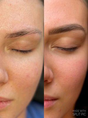 Before & After of semi permanent makeup 
The naturalness and fullness of Micro/Nano brows