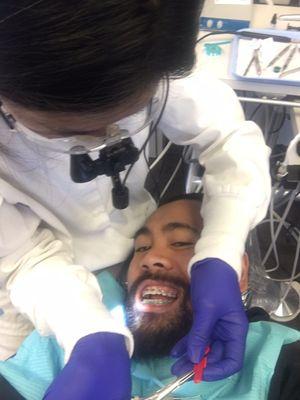 Getting my braces tightened