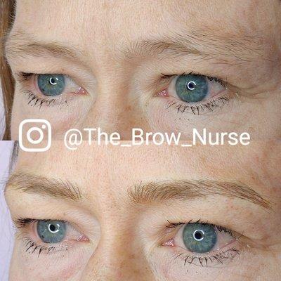 The Brow Nurse