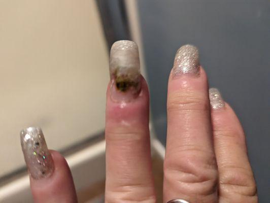 HERE'S ONE OF THE TWO INFECTED NAILS I GOT FROM NAIL LAB...8 DAYS AFTER SERVICE