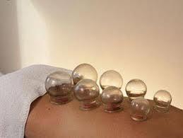 Cupping is used to relieve back and neck pains, stiff muscles, anxiety, fatigue, migraines, rheumatism, and even cellulite.