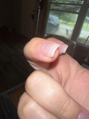 Cut up cuticle and glue