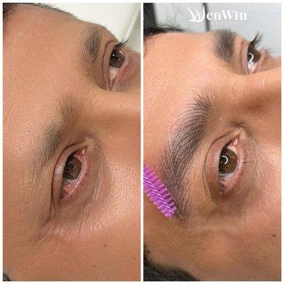 Healed hairtrocke brows