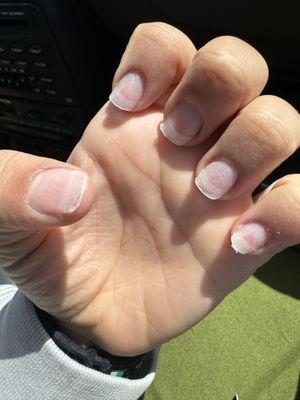 partially ripped off nails after requesting a refund