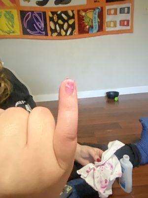 Her nail was split in half