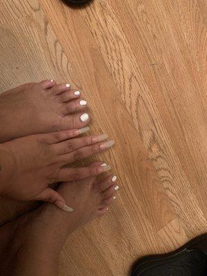 Feet and nails