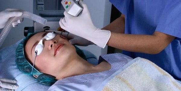 Fractional laser treatment