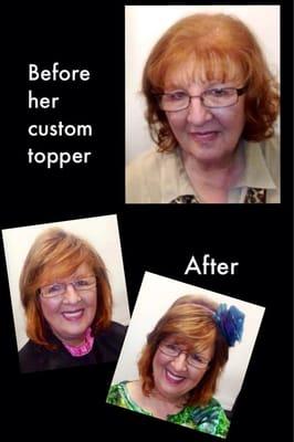 Before and after photos of client with thinning crown area.