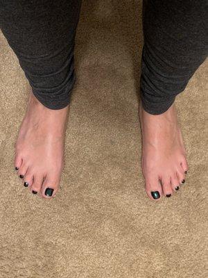 Bluish green toes!