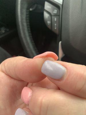 Cut under the nail