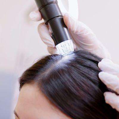 Our scalp analysis goes beyond the surface to provide a comprehensive understanding of your scalp health.