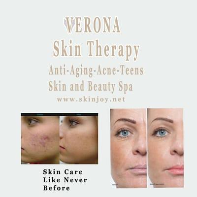 Best Skin Care.Reno,NV.Anti-Aging, Acne, Teen Facial