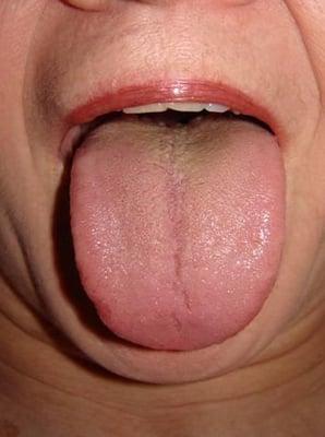 We use the traditional method of Tongue Diagnosis when creating Chinese herbal prescriptions.