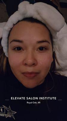 After a European Facial