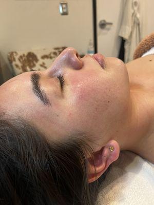 My client's first facial ever! I always begin with a very thorough consultation