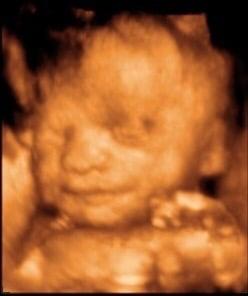 My little Princess Emalynn at 29weeks