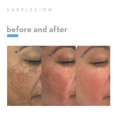 Experts in Dark Spots - results don't lie!