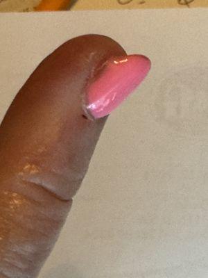 Bad workmanship - the clear gel goes over to my skin.