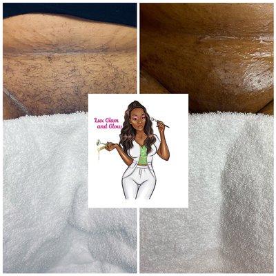 Brazilian wax and Vagacial Treatment