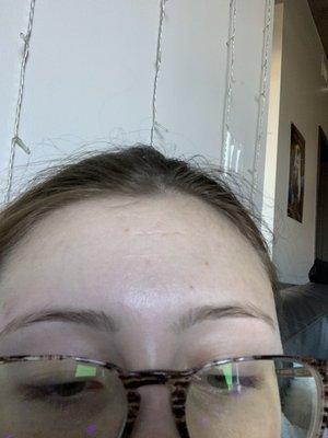 My uneven eyebrows. If you look at my nose bridge the one on the left has a chunk missing making it shorter.