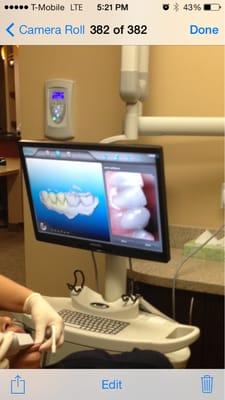 With this scanner patients can see an immediate before and after image of their aligned teeth! :)