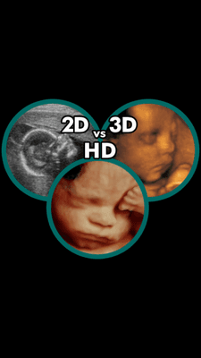 First in Orange Country to offer 4d HD Live ultrasounds.