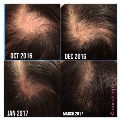 Monat longer stronger thicker hair in 90 days!!  Www.trishwatson.mymonat.com