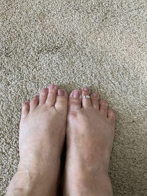 My pedicure