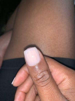 Terrible nail job