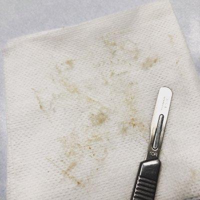 Dermaplaning involves using a medical-grade scalpel to gently remove dead skin cells and fine hair from the surface of your skin.