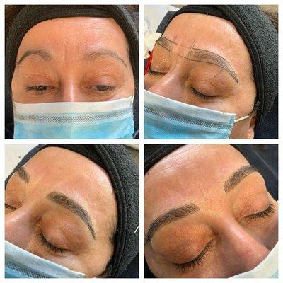 Microblading restores eyebrows