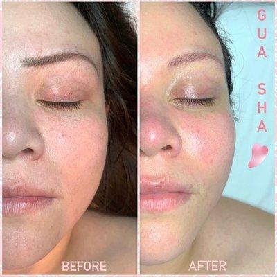 gua shua facial from Jasmine