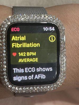 My heart rate