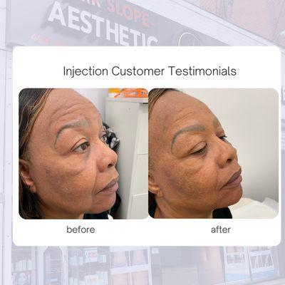 injection customer testimonial