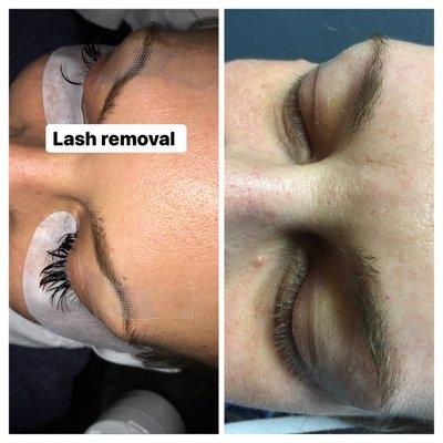 Eyelash extensions removal