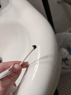 Bed bug - never experienced bed bugs in my life until this place