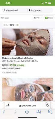 I paid $350 for a $200 peel