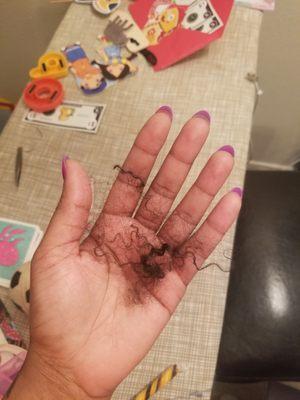 Hair that came out after incident