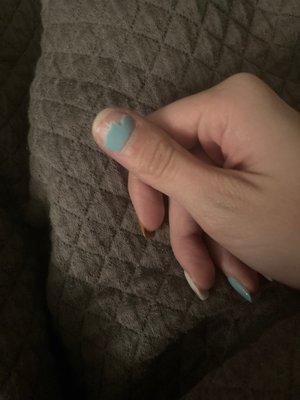 Broken nail