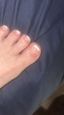 Red toes nail sore. Pedi 3-11-2024 picture 3-12-2024