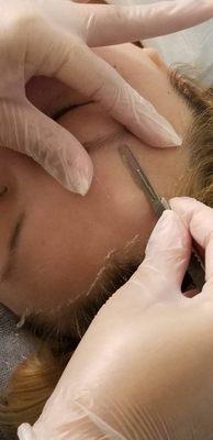 Dermaplaning