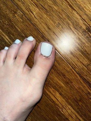 A week after pedicure my toe is still hurting.