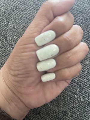 Gel fill