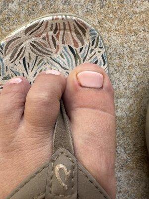 Infection starting on big toe