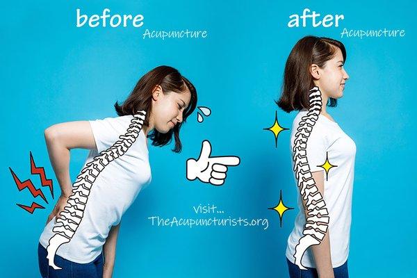 Relieve your back pain with the help of our chiropractors and acupuncturists