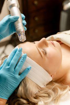 Rejuvenate skin with Radio frequency microneedling with Scarlet SRF.