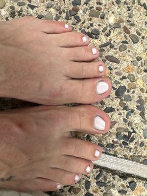 Day 4 after toes done