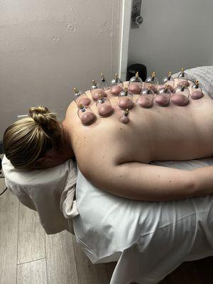 Cupping