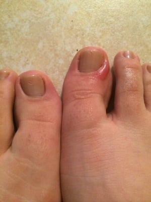 Sad pedicure :(