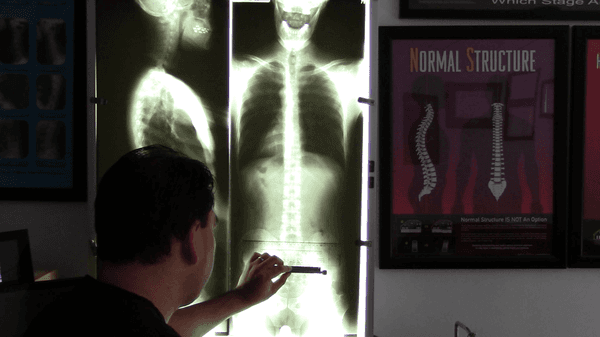 Gonstead Xray Analysis of the full spine.